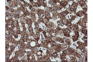 Immunohistochemistry (IHC) image for anti-Acetyl-CoA Acyltransferase 2 (ACAA2) antibody (ABIN1495726) (ACAA2 antibody)