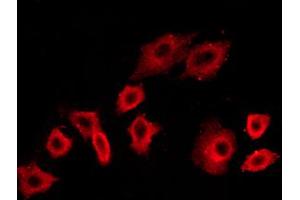 ABIN6267453 staining NIH/3T3 cells by ICC/IF. (PI3K p85 alpha/gamma antibody  (pTyr199, pTyr467))