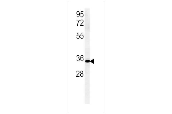 ZDHHC2 antibody  (N-Term)