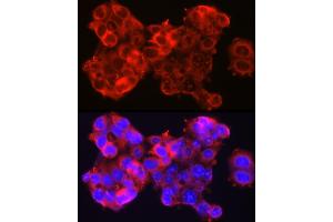 Immunofluorescence analysis of HepG2 cells using SSC/SerpinB3 Rabbit pAb (ABIN6131348, ABIN6147587, ABIN6147588 and ABIN6221070) at dilution of 1:100 (40x lens).