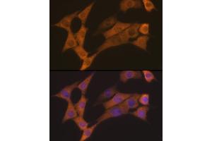 Immunofluorescence analysis of NIH-3T3 cells using Cyclin B2 Rabbit mAb (ABIN7266557) at dilution of 1:100 (40x lens). (Cyclin B2 antibody)