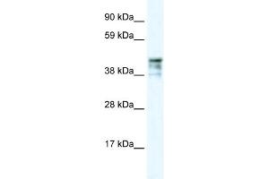 WB Suggested Anti-KRT15 Antibody Titration: 0. (KRT15 antibody  (C-Term))