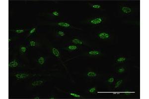 Immunofluorescence of monoclonal antibody to TGIF2 on HeLa cell. (TGIF2 antibody  (AA 114-175))