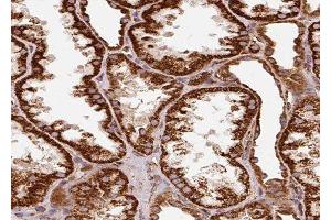 ABIN6278956 at 1/100 staining Human kidney tissue by IHC-P. (WNT7B antibody  (C-Term))