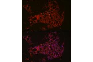 Immunofluorescence analysis of mouse brown adipose cells using UCP1 Rabbit pAb (ABIN6128899, ABIN6149883, ABIN6149885 and ABIN6221561) at dilution of 1:50 (40x lens). (UCP1 antibody  (AA 1-307))