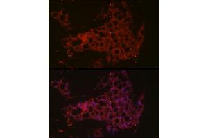 Immunofluorescence analysis of mouse brown adipose cells using UCP1 Rabbit pAb (ABIN6128899, ABIN6149883, ABIN6149885 and ABIN6221561) at dilution of 1:50 (40x lens). (UCP1 antibody  (AA 1-307))