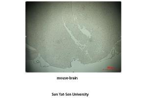 Immunohistochemistry (IHC) analysis: Please contact us for more details. (TH antibody  (Tyr161))