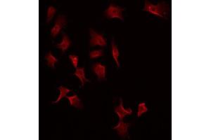 ABIN6275219 staining Hela by IF/ICC. (MASP2 antibody  (Internal Region))