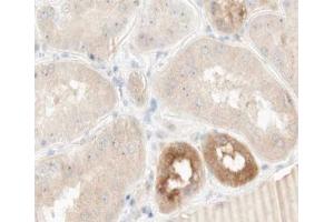 ABIN6266916 at 1/100 staining human kidney tissue sections by IHC-P. (TNFAIP2 antibody)