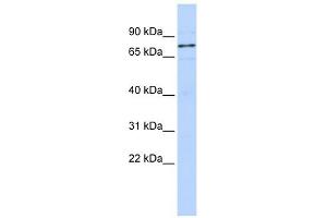 WBP11 antibody used at 1 ug/ml to detect target protein. (WBP11 antibody  (N-Term))