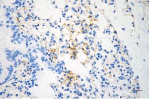 Immunohistochemistry was performed on paraffin-embedded mouse lung using caveolin 1 antibody (ABIN7797944), 1:200). (Recombinant Caveolin-1 antibody)