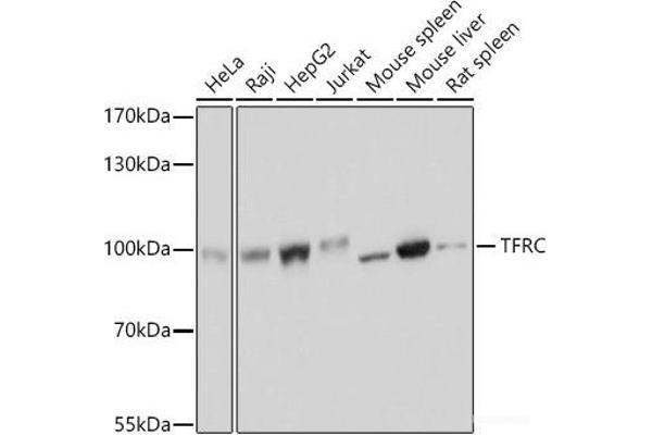 Transferrin Receptor antibody