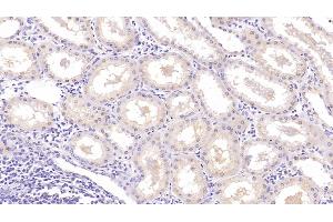 Detection of NRGN in Human Kidney Tissue using Monoclonal Antibody to Neurogranin (NRGN) (Neurogranin antibody  (AA 1-67))