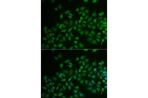 Immunofluorescence analysis of U2OS cell using MPP2 antibody.