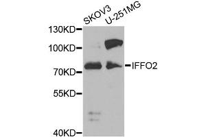 Western blot analysis of extracts of various cell lines, using IFFO2 antibody (ABIN5975600) at 1/1000 dilution. (IFFO2 antibody)