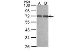 Image no. 2 for anti-Coiled-Coil Domain Containing 6 (CCDC6) (AA 1-232) antibody (ABIN467500) (CCDC6 antibody  (AA 1-232))