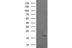 Image no. 1 for anti-Cancer/testis Antigen 1B (CTAG1B) antibody (ABIN1499901) (CTAG1B antibody)