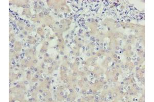 Immunohistochemistry of paraffin-embedded human liver tissue using ABIN7175806 at dilution of 1:100 (WDR91 antibody  (AA 1-747))