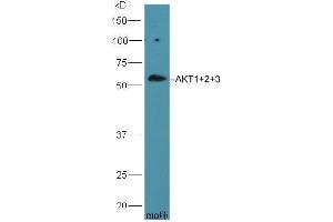 HepG2 lysate probed with Rabbit Anti-AKT1+2+3 Polyclonal Antibody (ABIN1387781) at 1:300 overnight in 4 °C. (AKT 1/2/3 antibody  (AA 401-480))