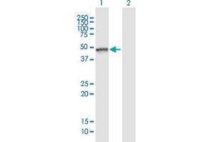 Western Blot analysis of TLE6 expression in transfected 293T cell line ( H00079816-T01 ) by TLE6 MaxPab polyclonal antibody. (TLE6 antibody  (AA 1-449))