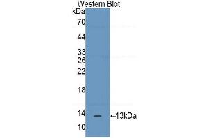 WB of Protein Standard: different control antibodies against Highly purified E. (IL17F ELISA Kit)