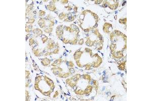 Immunohistochemistry of paraffin-embedded human stomach using B9D1 antibody. (B9D1 antibody  (AA 1-130))