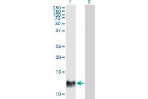 Western Blot analysis of HBXIP expression in transfected 293T cell line by HBXIP monoclonal antibody (M12), clone 4G1.