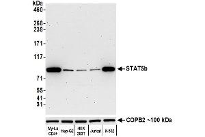 Western Blotting (WB) image for anti-Signal Transducer and Activator of Transcription 5B (STAT5B) (AA 737-787) antibody (ABIN7455110)