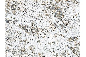 IHC analysis of Ezrin/EZR using anti-Ezrin/EZR antibody (ABIN7603214).