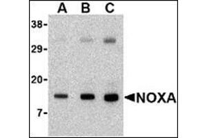 Western blot analysis of Noxa in human stomach tissue lysate with this product at (A) 0. (NOXA antibody  (N-Term))