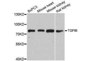 Western blot analysis of extracts of various cell lines, using TGFBI antibody (ABIN5971386) at 1/1000 dilution. (TGFBI antibody)