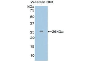Western Blotting (WB) image for anti-L1 Cell Adhesion Molecule (L1CAM) (AA 218-423) antibody (ABIN1173993)