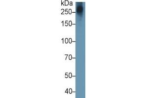 Mouse Capture antibody from the kit in WB with Positive Control:  Human Lymphocyte lysate. (Aggrecan ELISA Kit)