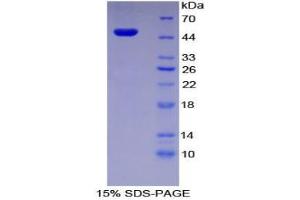 SDS-PAGE analysis of Human PAI1 Protein. (PAI1 Protein)