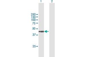 Western Blot analysis of WDR18 expression in transfected 293T cell line by WDR18 MaxPab polyclonal antibody. (WDR18 antibody  (AA 1-432))