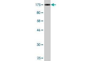 Western Blot detection against Immunogen (118. (ZKSCAN5 antibody  (AA 1-839))