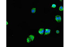 Immunofluorescent analysis of MCF-7 cells using ABIN7147419 at dilution of 1:100 and Alexa Fluor 488-congugated AffiniPure Goat Anti-Rabbit IgG(H+L) (CEP7 (AA 99-276) antibody)