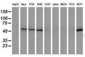Image no. 2 for anti-Sequestosome 1 (SQSTM1) antibody (ABIN1499991) (SQSTM1 antibody)