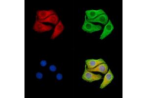 ABIN7096340 and ABIN7100402 staining Hela cells by IF/ICC. (RDH8 antibody)