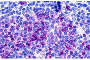 Image no. 1 for anti-G Protein-Coupled Receptor 160 (GPR160) (Extracellular Domain) antibody (ABIN1048744) (GPR160 antibody  (Extracellular Domain))