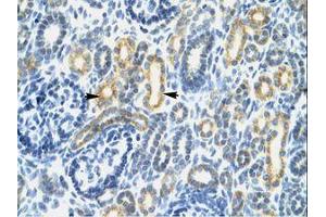Image no. 1 for anti-Interferon Regulatory Factor 8 (IRF8) (AA 35-84) antibody (ABIN202494) (IRF8 antibody  (AA 35-84))