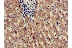 Immunohistochemistry of paraffin-embedded human liver tissue using ABIN7165664 at dilution of 1:100 (JAG1 antibody  (AA 809-1046))