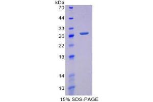 SDS-PAGE (SDS) image for Glutamate-Cysteine Ligase, Modifier Subunit (GCLM) (AA 40-251) protein (His tag) (ABIN2124980)