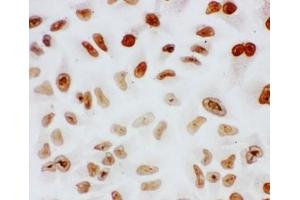 ICC testing of Splicing factor 1 antibody and HeLa cells (Splicing Factor 1 antibody  (N-Term))