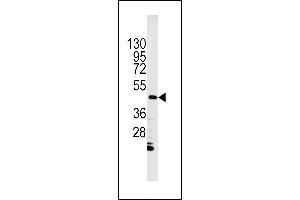 Western blot analysis of anti-ILK1 Pab (ABIN391993 and ABIN2841781) in HL60 cell lysate. (ILK antibody  (N-Term))