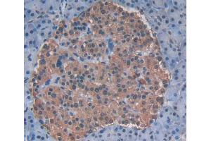 Immunohistochemistry (IHC) image for anti-ATP-Binding Cassette, Sub-Family F (GCN20), Member 2 (ABCF2) (AA 396-623) antibody (ABIN5013201)