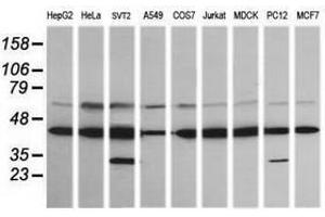 Image no. 1 for anti-Mitogen-Activated Protein Kinase Kinase 1 (MAP2K1) antibody (ABIN1499395) (MEK1 antibody)