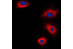Immunofluorescent analysis of VASP staining in HepG2 cells. (VASP antibody  (Center))
