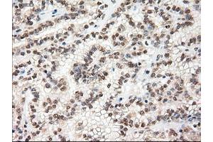 Image no. 10 for anti-Myc Proto-Oncogene protein (MYC) antibody (ABIN1497011) (c-MYC antibody)