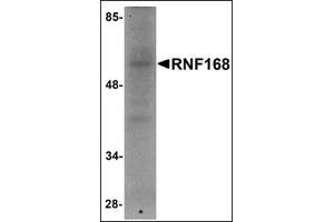 Western blot analysis of RNF168 in human brain tissue lysate with this product at 1 μg/ml. (RNF168 antibody  (C-Term))